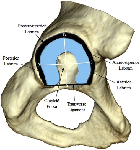 acetabular labral tear tests|acetabular labral calcification radiology.